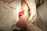  В Саратовской области культиватор раздробил пьяному мужчине ногу